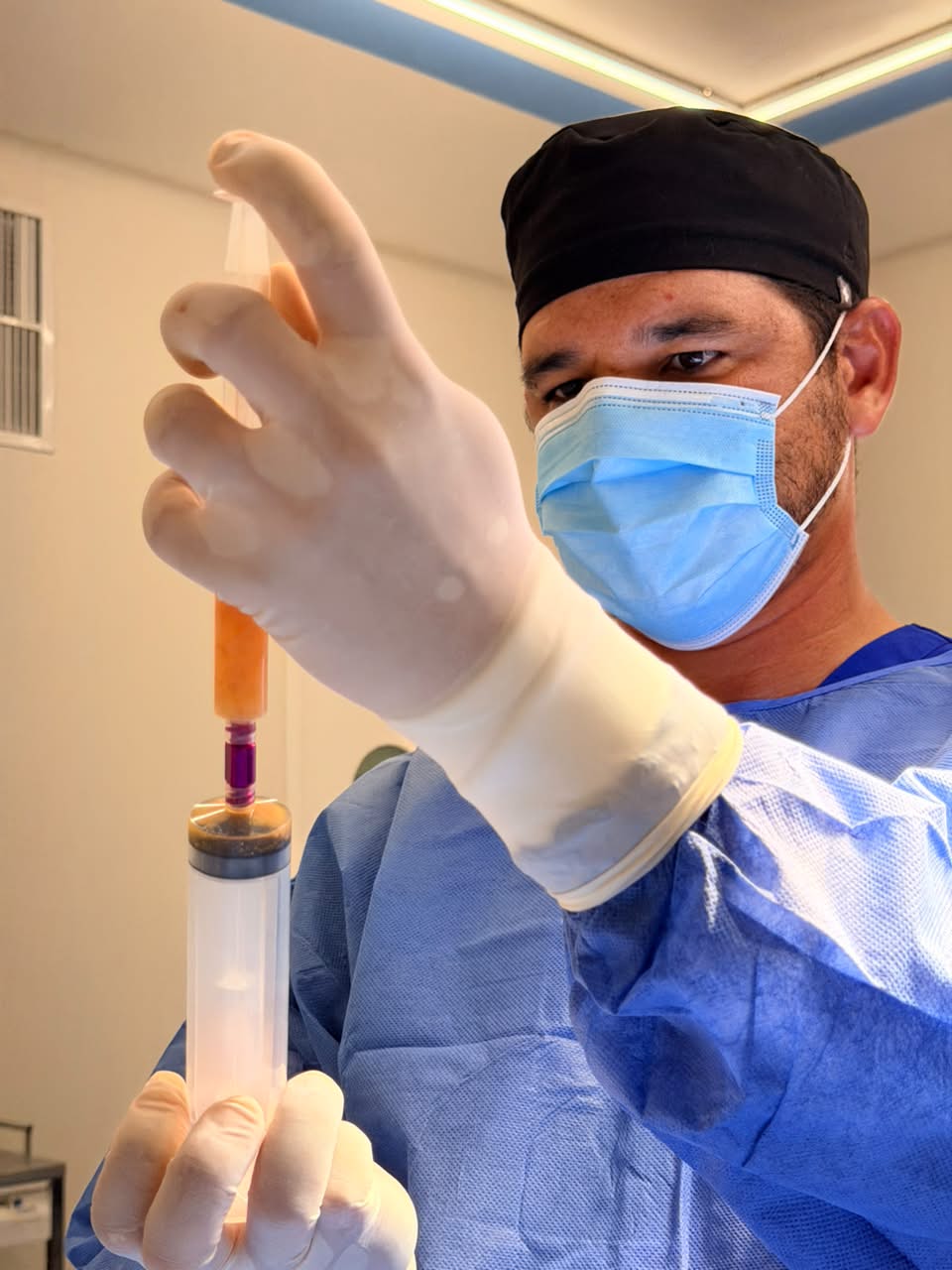 Procedimiento médico de micronizado de tejido adiposo